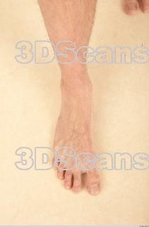 Photo reference of foot 0004